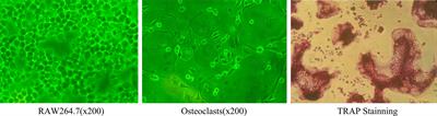 Interleukin-35 Is Involved in Angiogenesis/Bone Remodeling Coupling Through T Helper 17/Interleukin-17 Axis